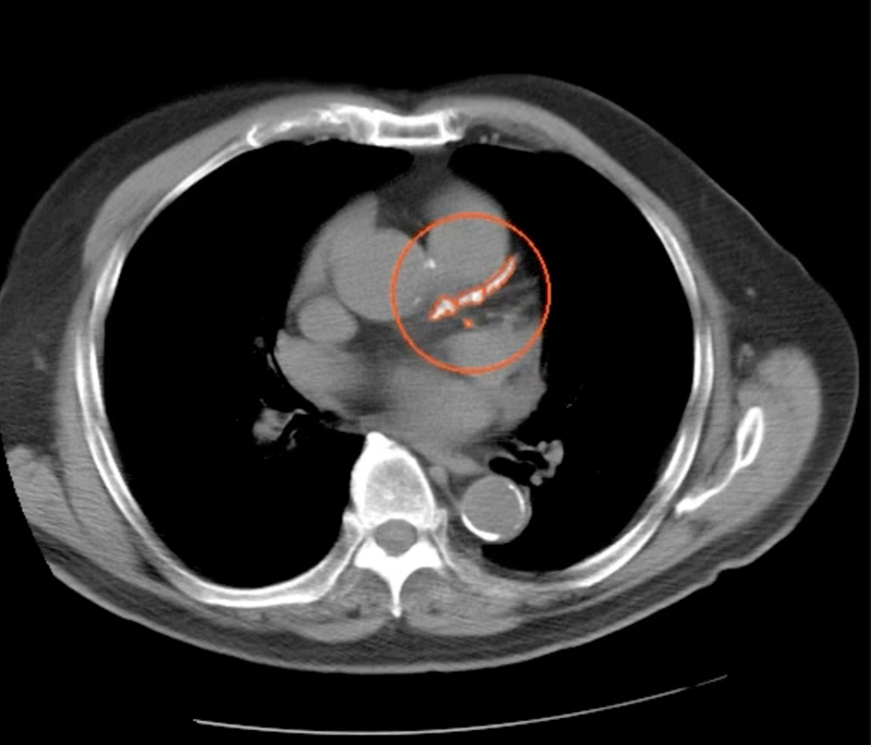 McLaren Health Care Launches First-of-its-Kind AI-Powered Cardiovascular Screening in Michigan